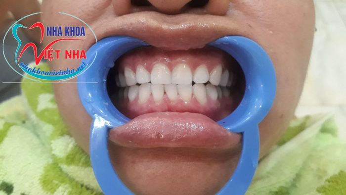 Hệ thống máy móc tối tân tại Nha Khoa Việt Nha Bình Dương