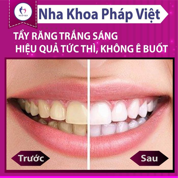 Không gian hiện đại và sang trọng tại Nha Khoa Pháp Việt Bình Dương