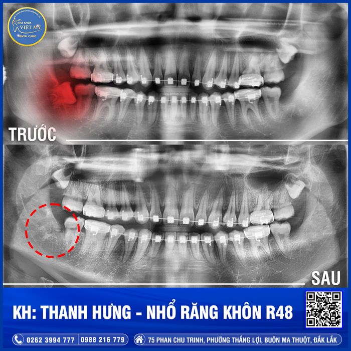 Nha Khoa Việt Mỹ - Hình ảnh 2