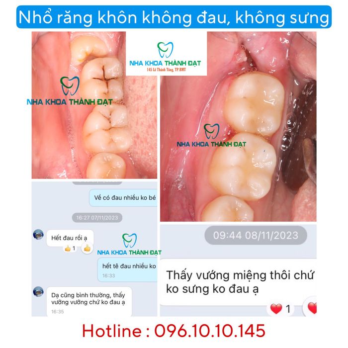 Nha Khoa Thành Đạt - Hình ảnh 2