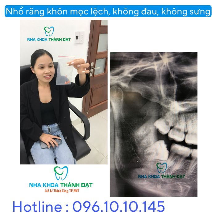 Nha Khoa Thành Đạt - Hình ảnh 1