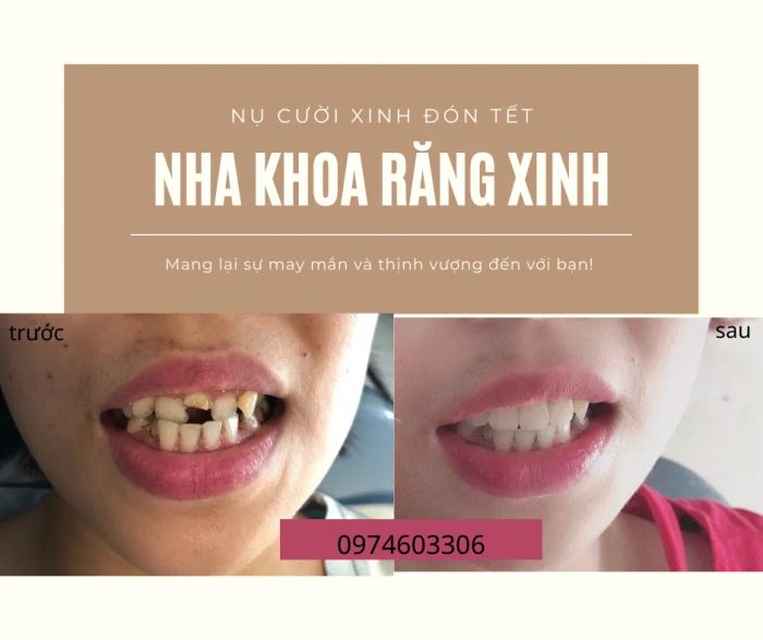 Hình ảnh Nha Khoa Răng Xinh - Cao Bằng 1