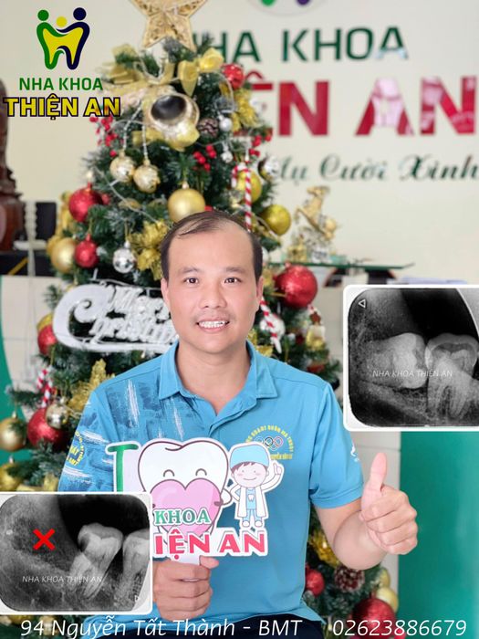 Nha Khoa Thiện An - Hình ảnh 1