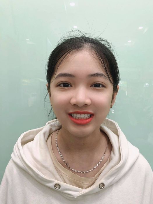 Nha Khoa Best Smile hình ảnh 2