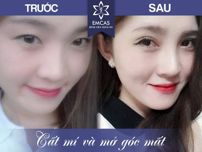 Hình ảnh thực tế Bệnh viện Thẩm mỹ EMCAS