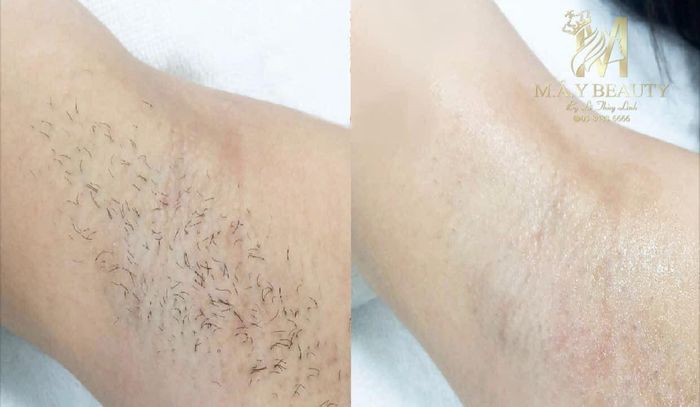 Mây Beauty Spa ảnh 1