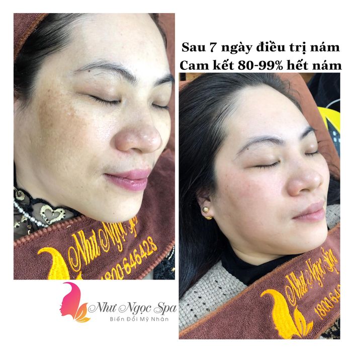 Như Ngọc Spa ảnh 2