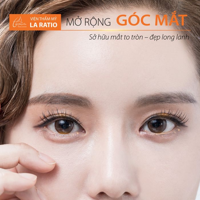 Hình ảnh thực tế dịch vụ tại Viện Thẩm Mỹ La Ratio
