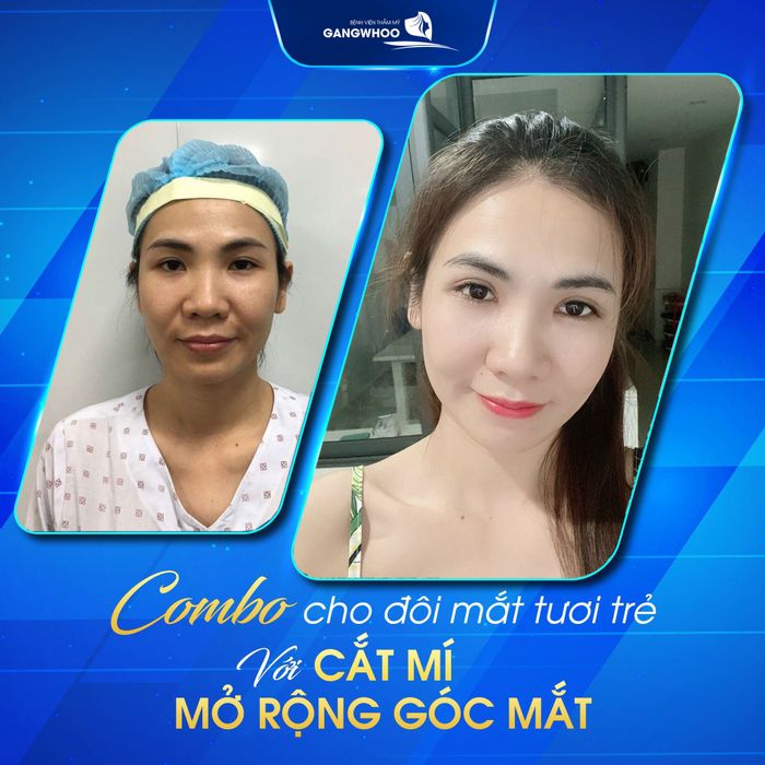 Hình ảnh thực tế Bệnh viện Thẩm mỹ Gangwhoo