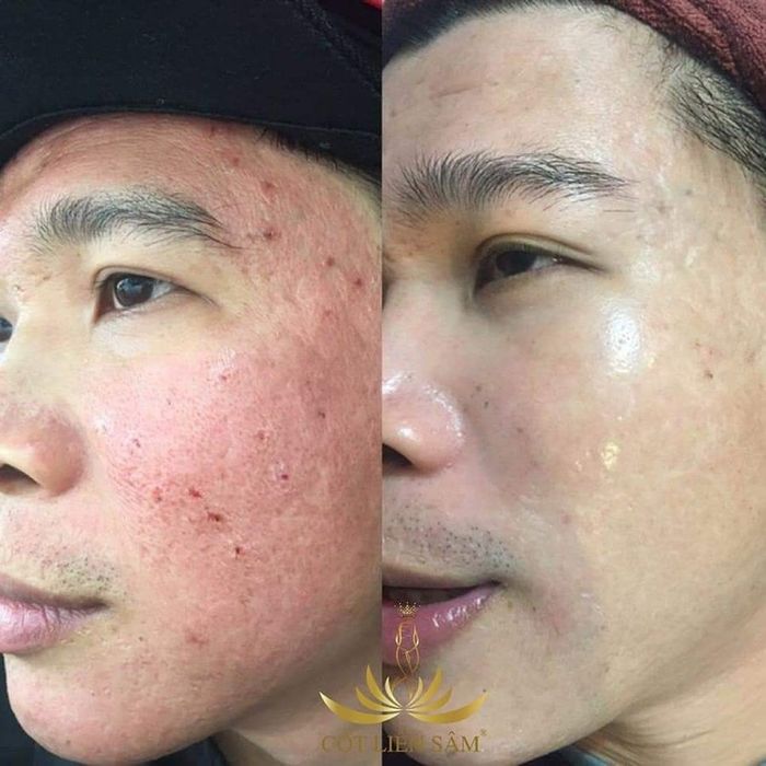 LX Spa ảnh 1 - Khoảnh khắc giao thoa giữa nghệ thuật và khoa học làm đẹp