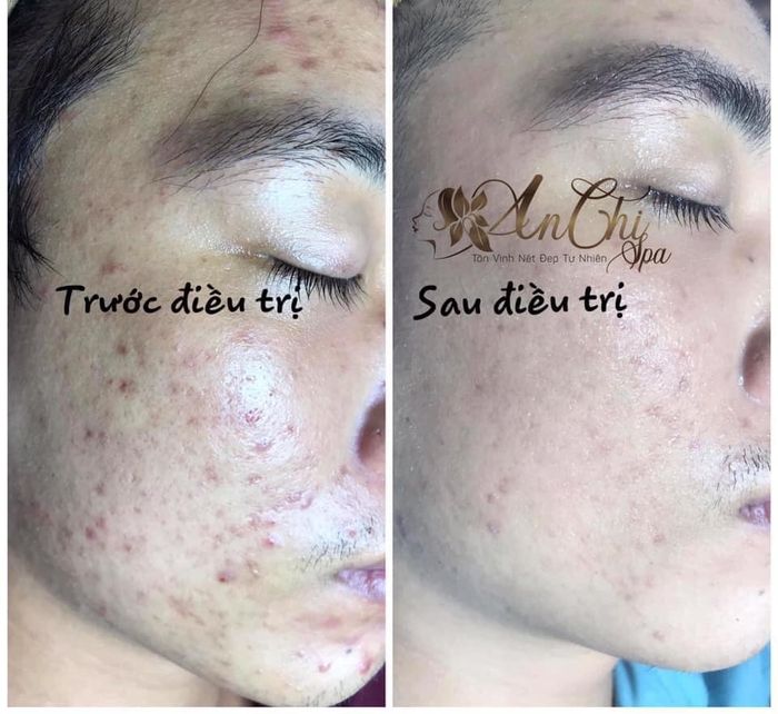 Hình ảnh không gian trị liệu tại An Chi Spa