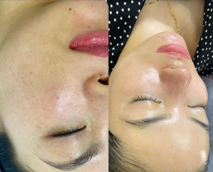 Không gian sang trọng đạt chuẩn tại Hằng Nga Spa
