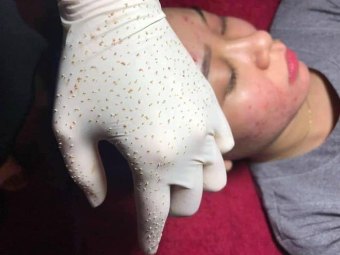 Spa Quỳnh Anh ảnh 1 - Khoảnh khắc tỏa sáng của làn da hoàn hảo