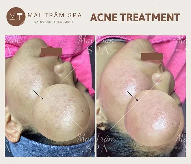 Spa làm đẹp tại Đà Nẵng