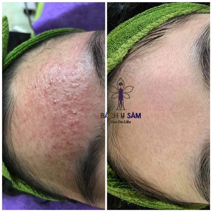 Spa Anh Nguyễn ảnh 1 - Tác phẩm nghệ thuật từ bàn tay chuyên gia