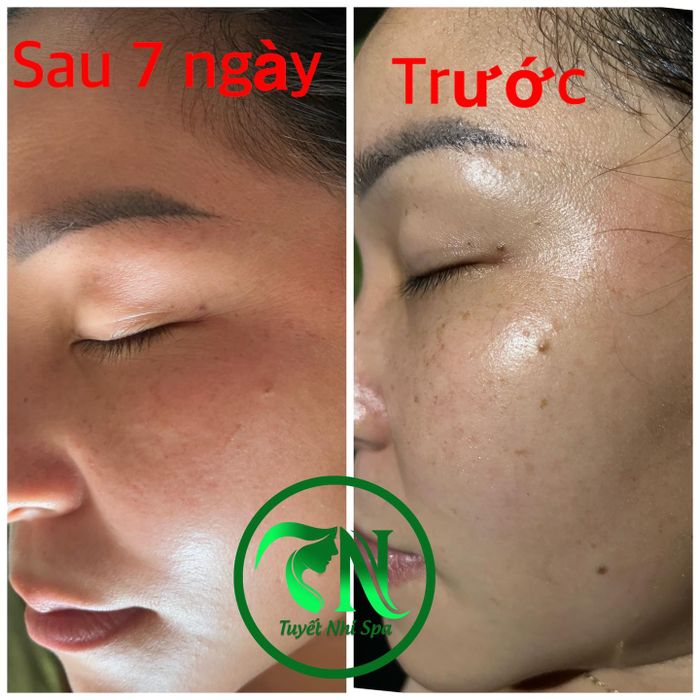 Quy trình chăm sóc da chuyên nghiệp tại Tuyết Nhi Spa