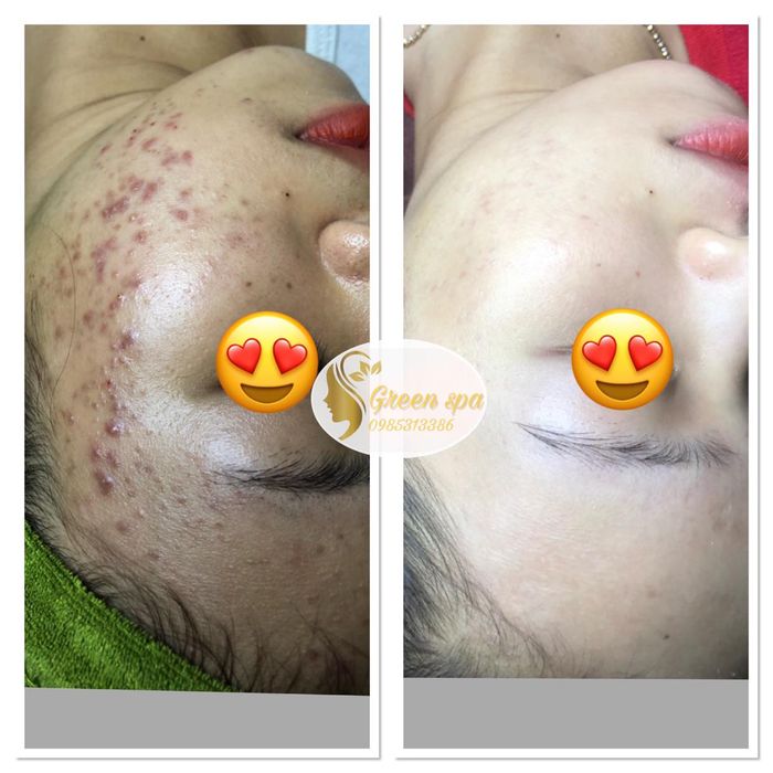 GreenSpa ảnh 2 - Khoảnh khắc vàng lưu giữ vẻ đẹp rạng ngời