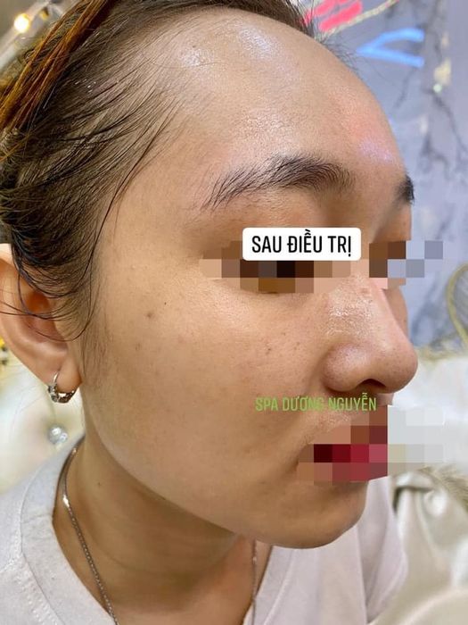 Thẩm Mỹ Công Nghệ Cao Dương Nguyễn ảnh 2 - Hành trình tìm lại thanh xuân