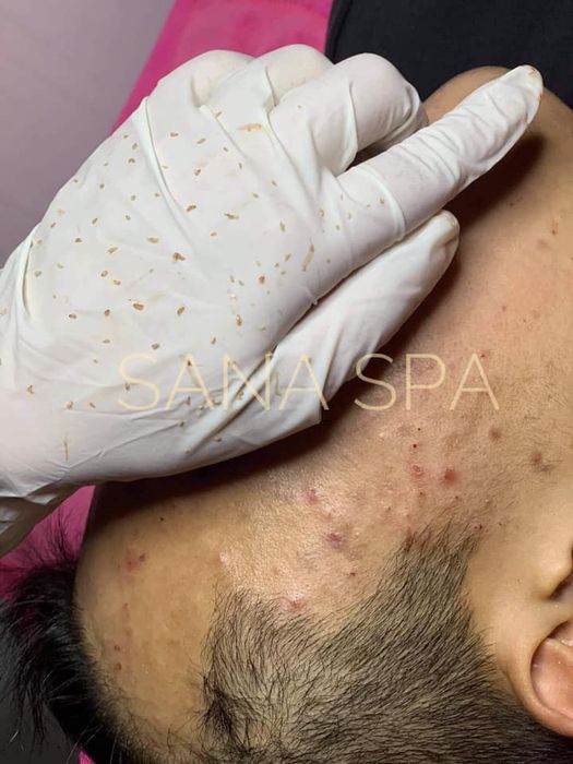 Sa Na'Spa ảnh 1 - Khoảnh khắc lột xác đầy ấn tượng