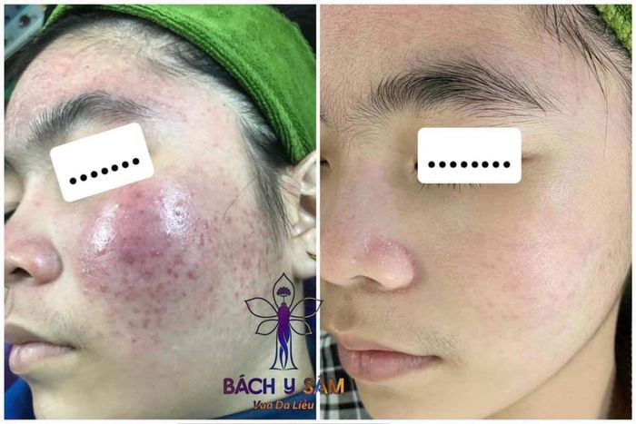 Spa Anh Nguyễn ảnh 2 - Khoảnh khắc lột xác đầy ấn tượng