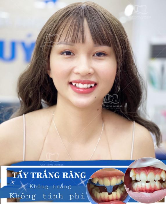 Nha Khoa Quý Tùng Thái Nguyên - Hình Ảnh 2