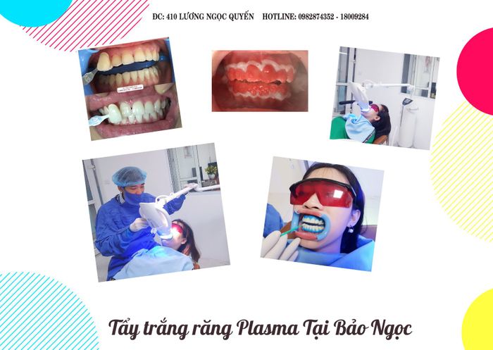 NHA KHOA BẢO NGỌC - Hình Ảnh Thực Tế