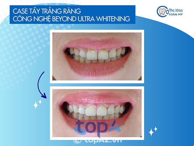 Nha Khoa Toàn Mỹ TP Cao Lãnh, địa chỉ đáng tin cậy cho những ai quan tâm đến sức khỏe răng miệng.