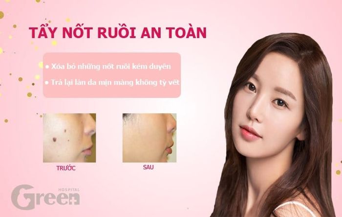 Hệ thống máy móc hiện đại nhập khẩu châu Âu tại GREEN