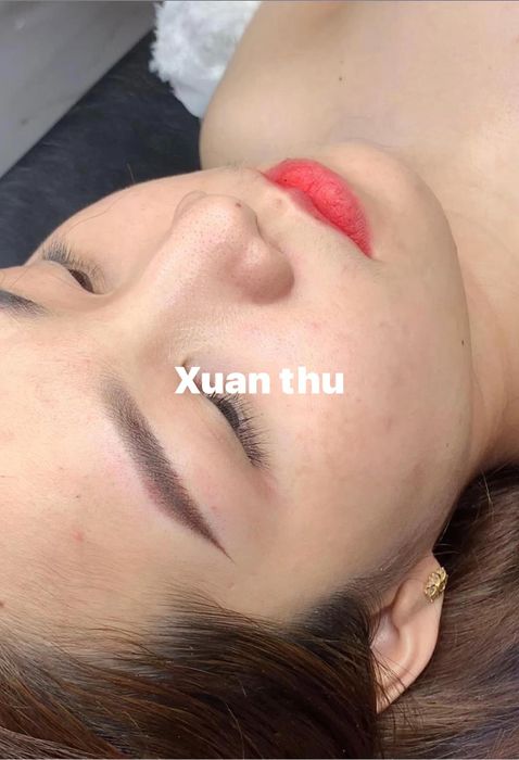 Hình ảnh thực tế dịch vụ tại Thẩm Mỹ Xuân Thu