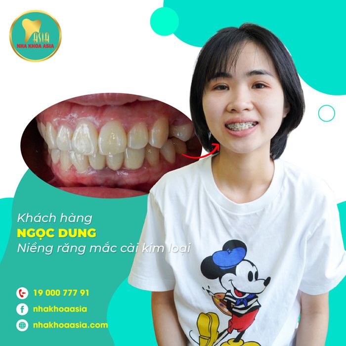 Hình ảnh đội ngũ bác sĩ chuyên môn cao tại Nha khoa Asia