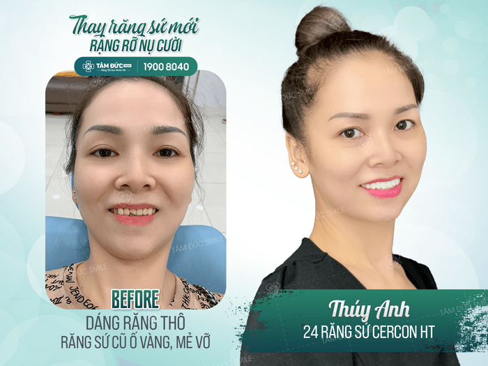 Nha Khoa Tâm Đức Smile hình ảnh 2