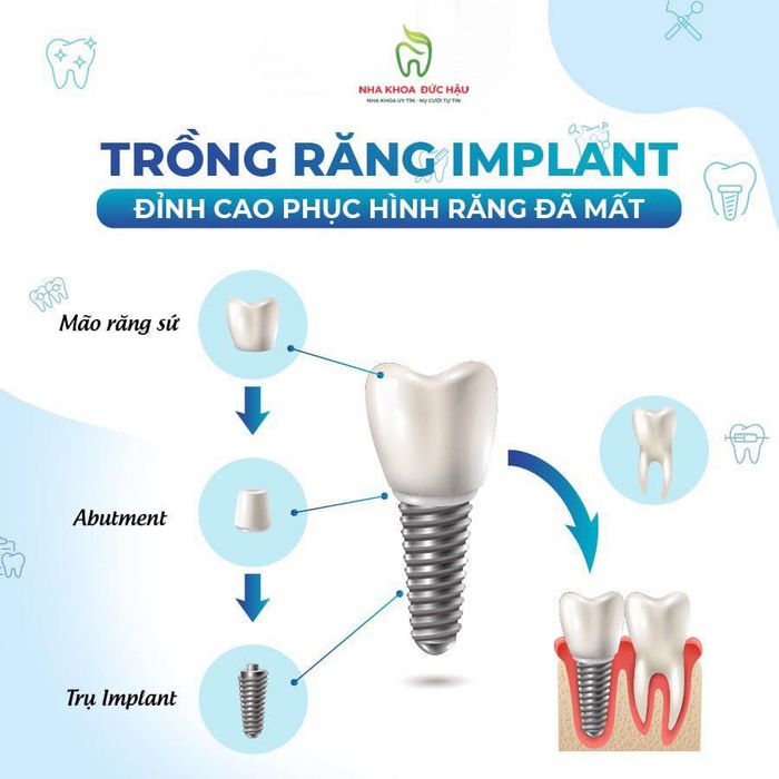 NHA KHOA ĐỨC HẬU - Hình ảnh 1