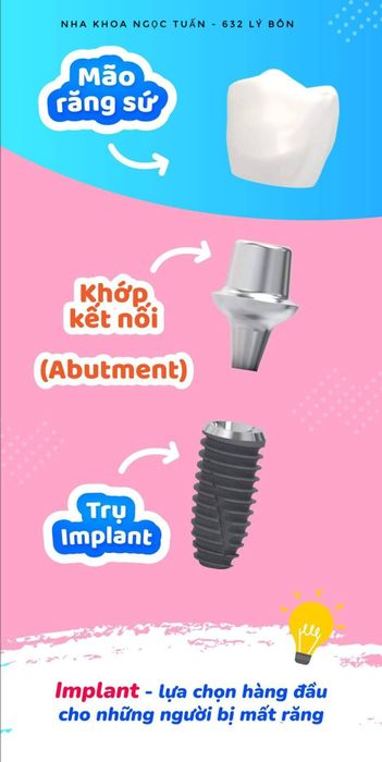 NHA KHOA NGỌC TUẤN - Hình ảnh 3