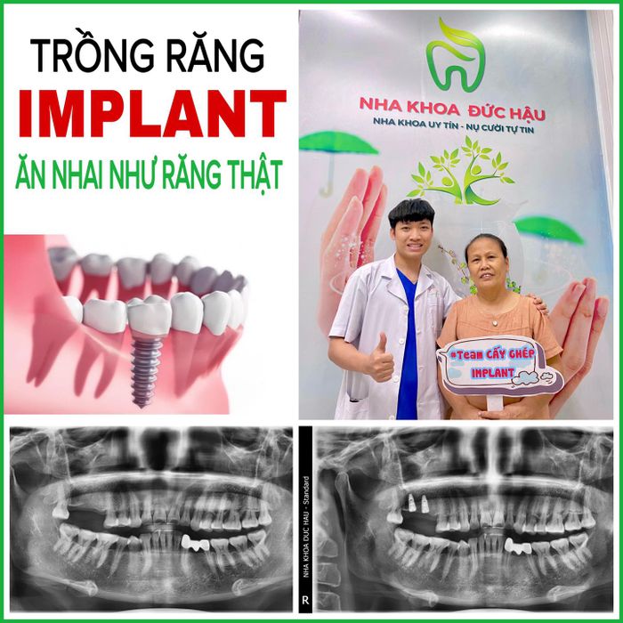 NHA KHOA ĐỨC HẬU - Hình ảnh 2