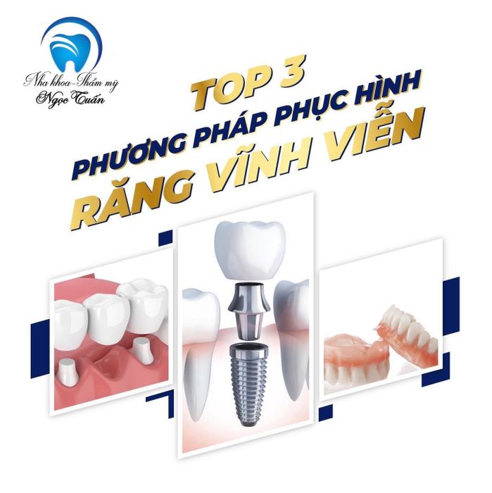 NHA KHOA NGỌC TUẤN - Hình ảnh 2