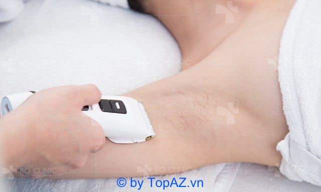 Bo Clinic là lựa chọn uy tín cho dịch vụ triệt lông tại Quận 10 mà bạn không thể bỏ qua.