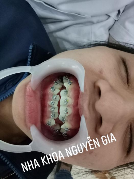 Nha khoa Nguyễn Gia ảnh 1