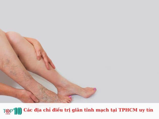 Danh sách các cơ sở điều trị giãn tĩnh mạch uy tín tại TPHCM