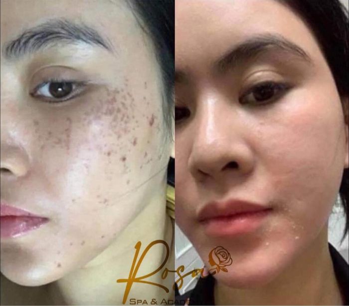 Không gian sang trọng tại Viện Thẩm Mỹ Hường Rosa
