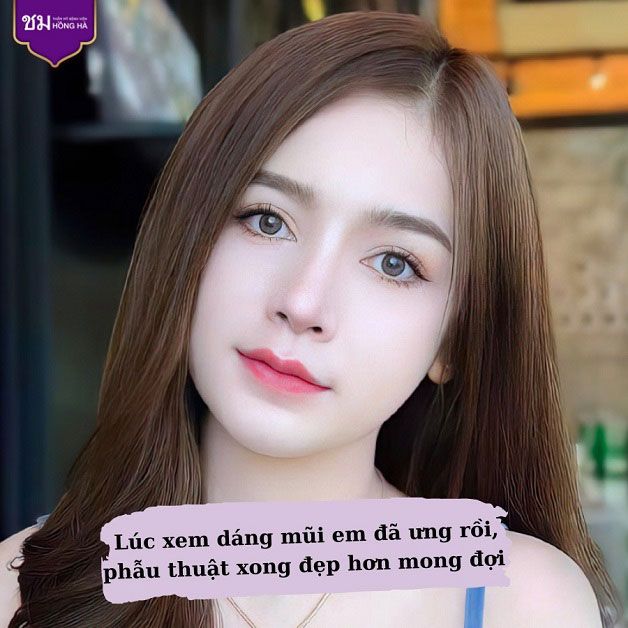 Hình ảnh kết quả nâng mũi ấn tượng tại Thẩm Mỹ Bệnh Viện Hồng Hà