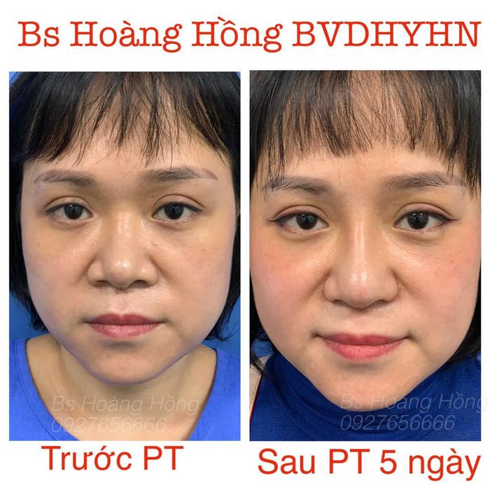 Hình ảnh nổi bật về Trung tâm Phẫu thuật Thẩm mỹ - Bệnh viện Đại học Y Hà Nội