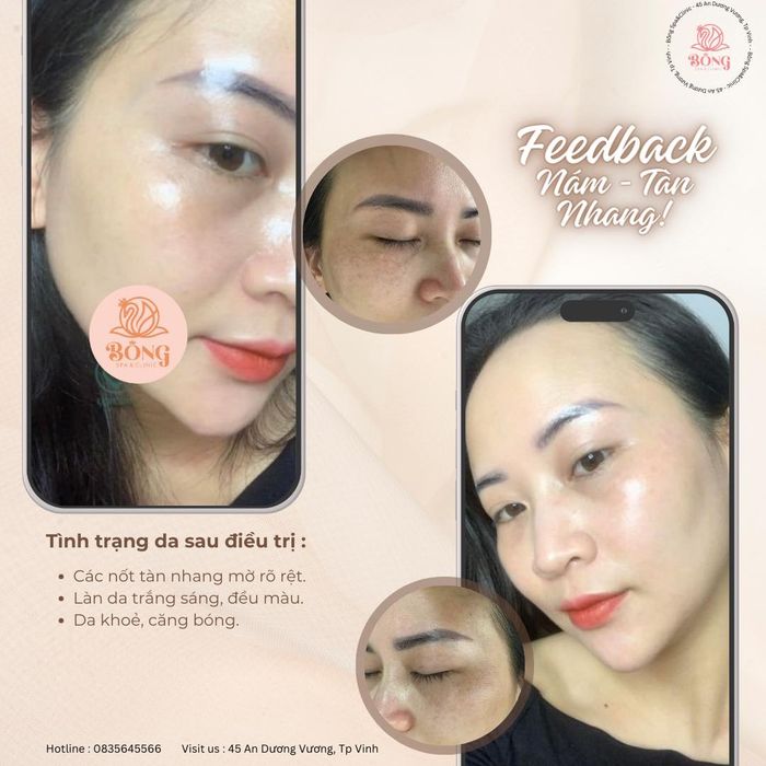 Hình ảnh Bông Spa - Healthy & Beauty