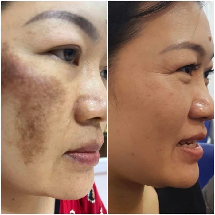 Không gian trị liệu sang trọng tại Hana Spa