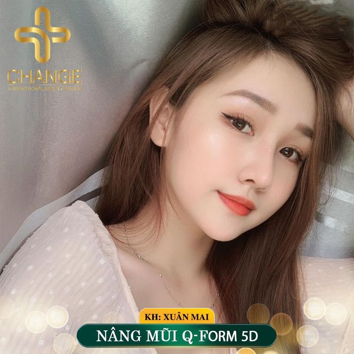 Hình ảnh Thẩm mỹ viện Quốc tế 5 Sao Change - Địa chỉ nâng mũi uy tín