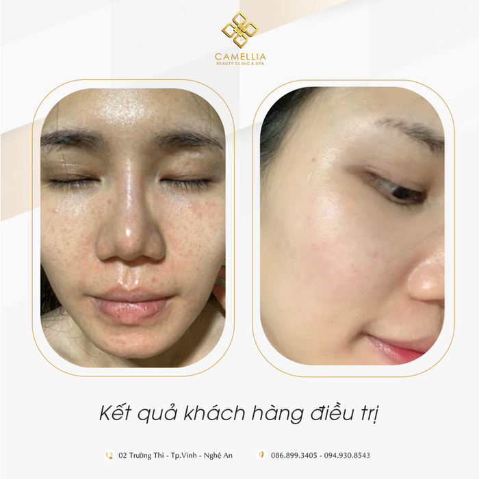 Không gian sang trọng tại Camellia Luxury Spa