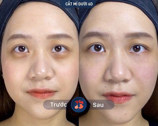 Hệ thống phòng phẫu thuật đạt chuẩn tại Kangnam