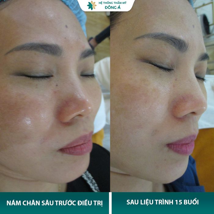 Hình ảnh thực tế tại Thẩm Mỹ Viện Đông Á - Chi nhánh Nghệ An