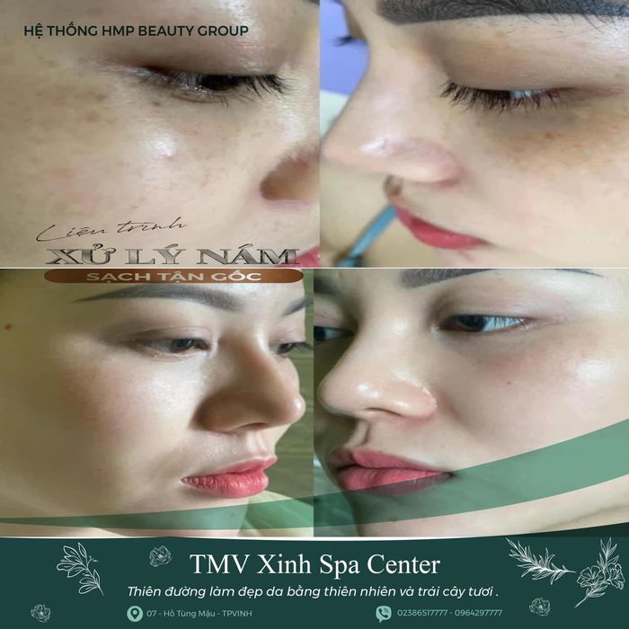 Không gian sang trọng tại Viện Thẩm Mỹ Xinh Spa
