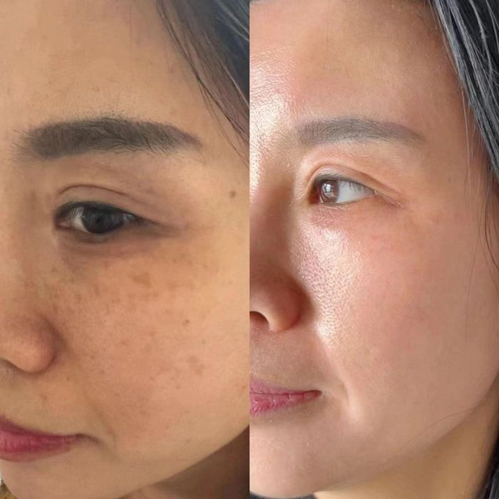 Không gian trị liệu cao cấp tại Viện Thẩm Mỹ Hường Rosa