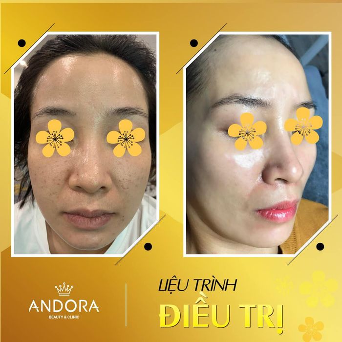 Không gian sang trọng tại Andora Beauty & Clinic